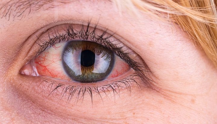Olhos vermelhos ajudam a diagnosticar doenças