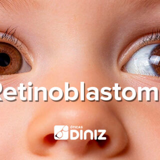 Montagem com bebê com retinoblastoma no centro.