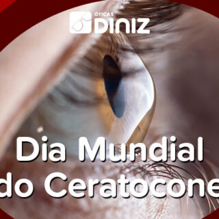 Na imagem, há uma foto do olho de uma pessoa de perfil, mostrando a córnea em formato de "cone", típica do Ceratocone.